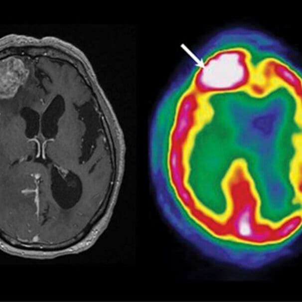 Diagnostic Neuroimaging Psychiatry & Neurology Physician