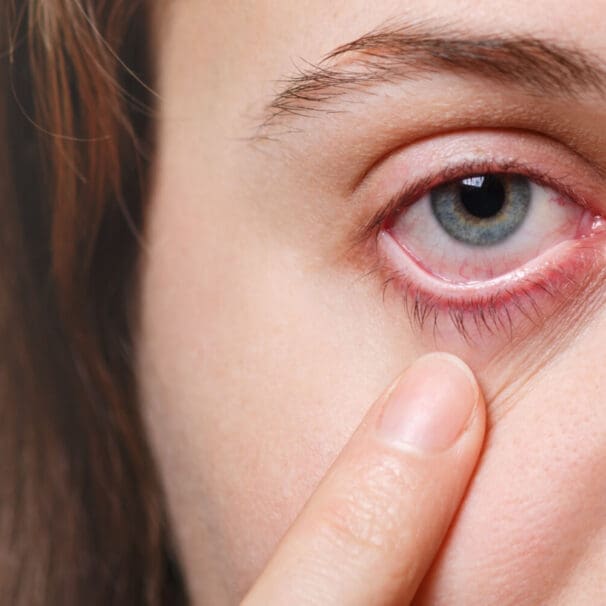Cornea and External Diseases Specialists