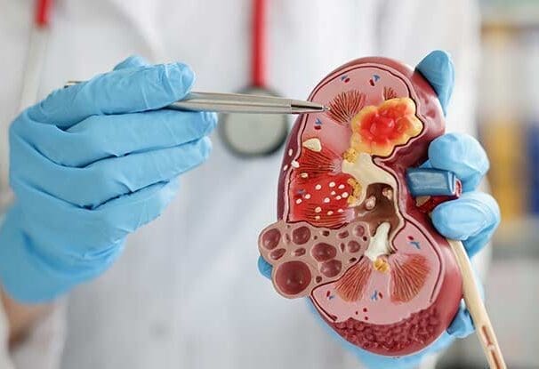 Nephrologists