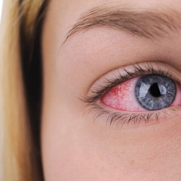 Uveitis and Ocular Inflammatory Disease Ophthalmologists